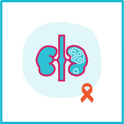 Kidney Cancer